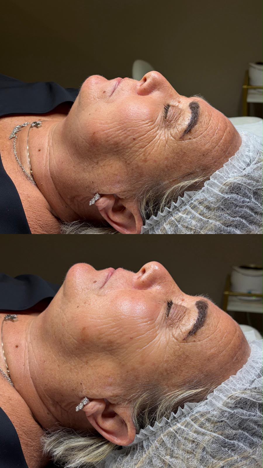 Risultati Prima e Dopo Protocollo Ageless